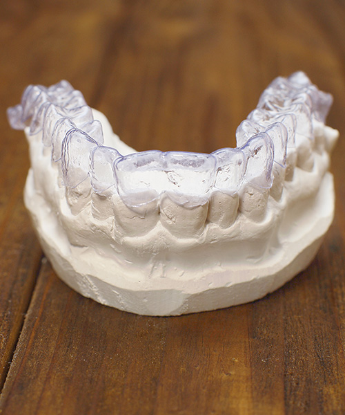 Invisalign